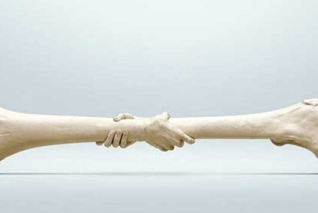 همه چیز درباره پوکی استخوان/ با این غذاها پوکی استخوان را برطرف کنید