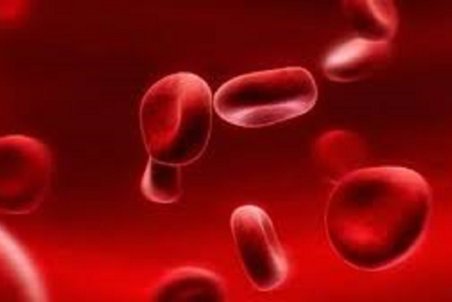 علائم کمبود آهن که باید آن را جدی بگیرید