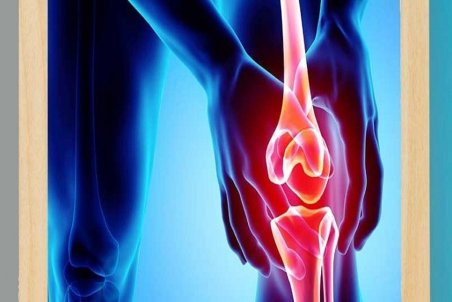 ورزش‌هایی برای جلوگیری از آرتروز