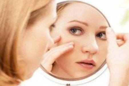 کدام قسمت از صورتتان جوش می زند؟ + علت و درمان