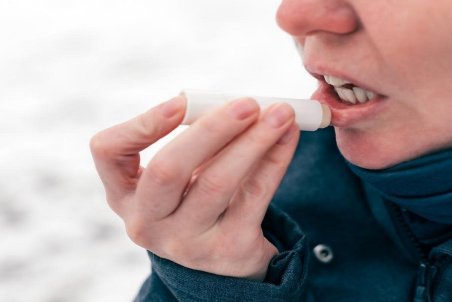 ۴ روش خانگی برای درمان خشکی لب در پاییز