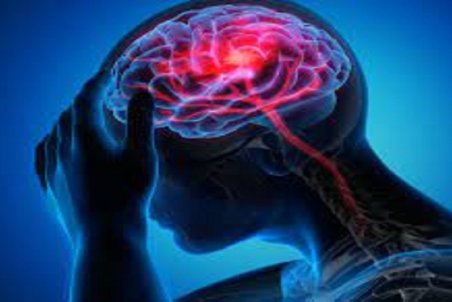 پیشگیری از سکته مغزی با چند راهکار ساده