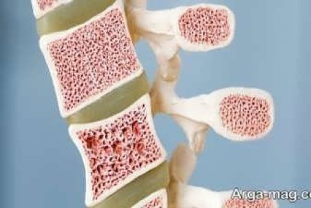 نحوه تشخیص سرطان مغز استخوان و درمان آن