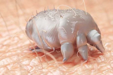 درمان بیماری گال با چند راهکار خانگی