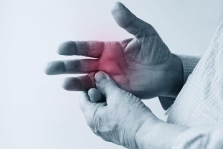 علائم اولیه آرتریت روماتوئید چیست؟