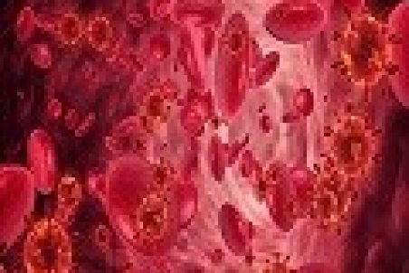 علائم کم خونی در مردان چیست؟