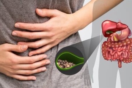 انگل‌های گوارشی؛ مهمان ناخوانده بدن