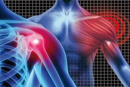 علائم پارگی تاندون‌های شانه و روش‌های درمان آن