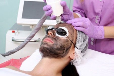 لیزر کربن چیست و چه فوایدی دارد؟