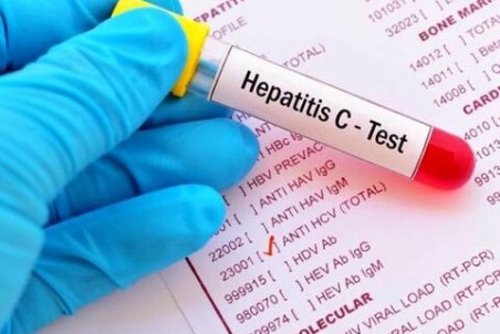 هپاتیت؛ از پیشگیری تا درمان