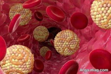 علائم کلسترول بالا چیست؟