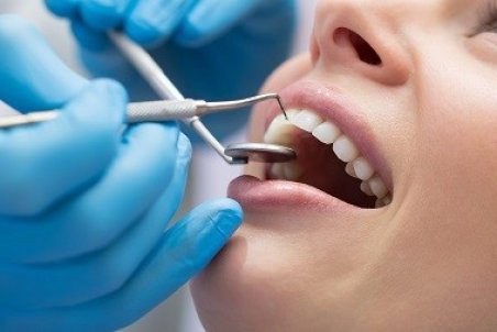 نکاتی برای حفاظت از دندان عصب کشی شده