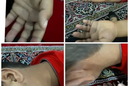 شکنجه دانش آموز کلاس اول توسط معلم / یک هفته است ابوالفضل شب‌ها با وحشت از خواب می‌پرد