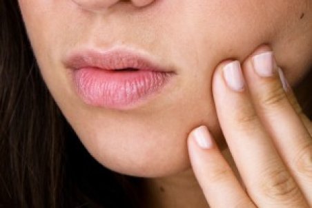درمان سریع زخم دهان با نسخه های خانگی