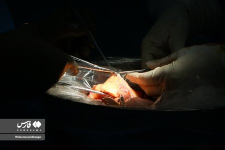 (تصاویر) اهدای اعضای بدن دختر نخبه قربانی جراحی زیبایی