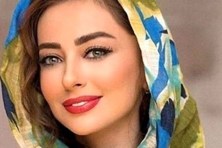 “نفیسه روشن” مورد ضرب و شتم و خشونت خانگی قرار گرفت! + عکس دست کبود وی