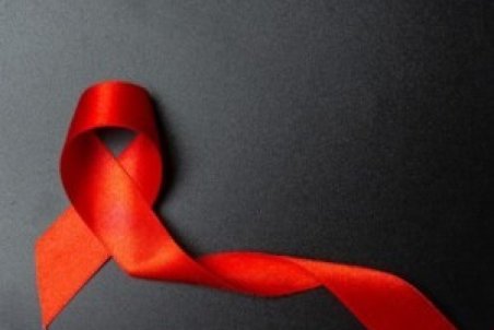 علائم و مراحل ایدز یا HIV