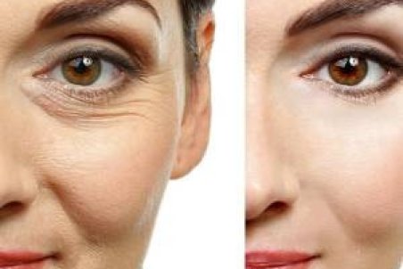 بوتاکس طبیعی صورت با ماسک های طبیعی در منزل