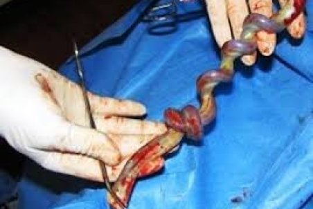 این زباله "نجات‌بخش" را دور نریزید!