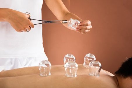 آشنایی با روش بادکش ریه