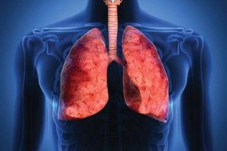 علائم هشدار دهنده عفونت ریه چیست؟