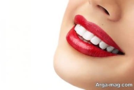 فایبر پست دندان چیست؟