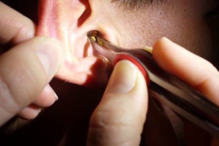 دلیل بوی بد جرم گوش و آنچه این چسبناک زرد به شما می گوید