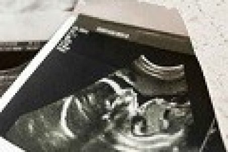 مردم از سر فقر سقط جنین می‌کنند!