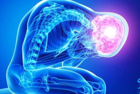 با تمام مراقبت های بعد از سکته مغزی آشنا شوید