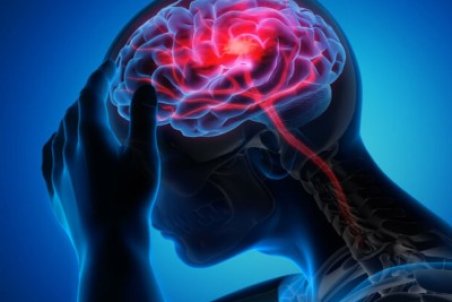 چند بیماری که با ام.اس اشتباه گرفته می‌شود