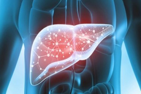 عوارض کبد چرب چیست؟ + فیلم