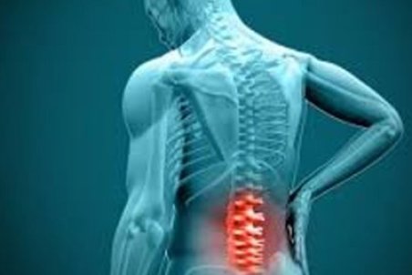 علائم و راه‌های درمان دیسک کمر + فیلم