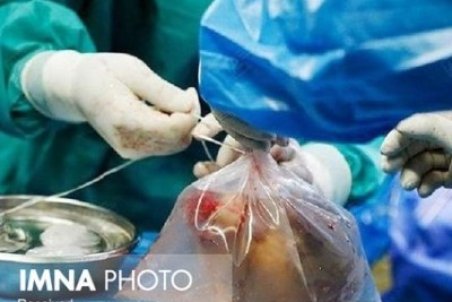 ۲۵ هزار بیمار در انتظار پیوند عضو/مرگ روزانه ۷ تا ۱۰ نفر به علت نرسیدن عضو پیوندی