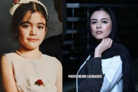 تغییر چهره ماهور الوند از گذشته تا کنون