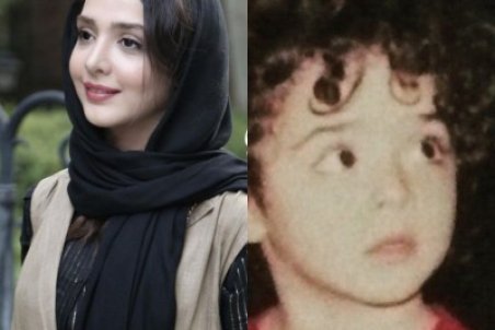 تغییر چهره المیرا دهقانی از گذشته تا امروز