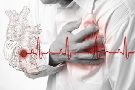 آنچه از سکته قلبی نمی دانید