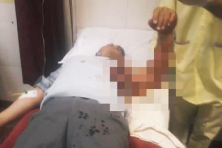 حمله فرد متخلف به مامور شهرداری تبریز با چاقو