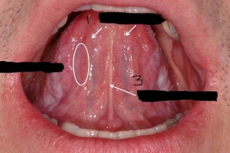 برامدگی و توده در زبان نشانه چیست؟