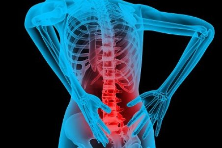 ۹۰ درصد موارد درد کمر و گردن ناشی از ضعف عضلانی است