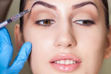 لیفت شقیقه چیست؟ همه چیز درباره عمل لیفت شقیقه