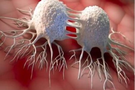 امکان تشخیص دقیق توده‌های سرطانی با ابزار ایران‌ساخت