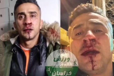 در گیری خونین در اتوبوس پدیده