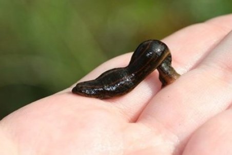 آیا از "زالودرمانی" می‌توان برای درمان بیماری‌های مختلف استفاده کرد؟!