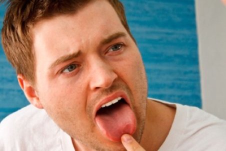 علت خشکی دهان چیست؟ + فیلم