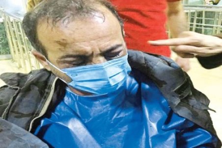 روایت تازه از اسیدپاشی تلخ شاهین‌شهر