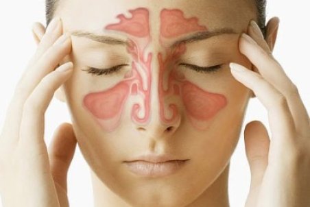 درمان خانگی سینوزیت