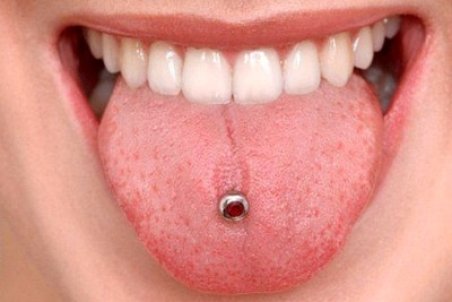 عوارض پیرسینگ یا سوراخ کردن زبان