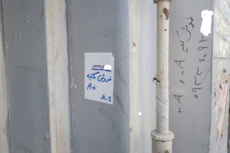 ۲۱۴۶ بیمار در صف پیوند کلیه/ هشدار درباره دیوارنوشته‌های کلیه‌فروشی