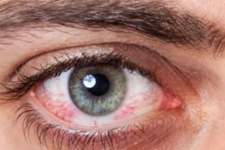 ۶ عفونت‌ چشمی فاجعه‌بار