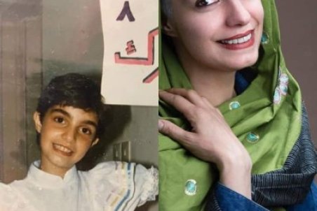 تغییر چهره الیکا عبدالرزاقی از گذشته تا کنون